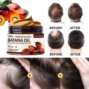 Batana Öl für Haarwachstum gesünder dicker voller Anti Haarausfall 100% natürlich - Bild 1 von 24