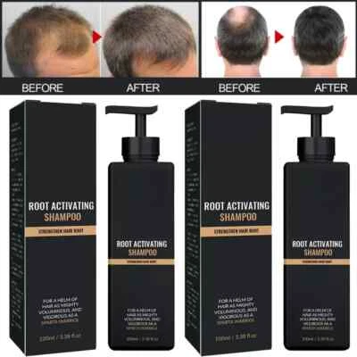 1-3PCS Root Activator Shampoo, SPARTAN Hair Loss Shampoo,Shampoo Root Activator - Image 1 of 4