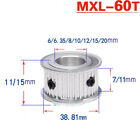 1Pcs Mxl60t Timing Belt Pulley Gear Wheel 5-20Mm Bore For 7/11Mm Width Belt