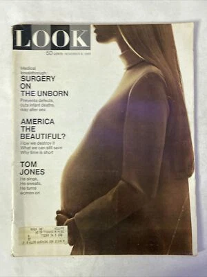 1969 November 4, LOOK Magazine, Surgery On The Unborn (BM15) Foto 1 de 3