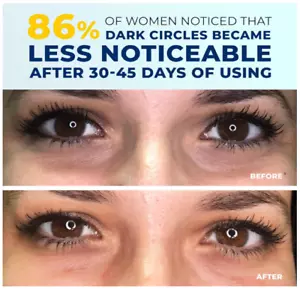 Eye Cream for Dark Circles & Puffiness, Under Eye Bags Hydrating Caffeine Cream - Picture 1 of 7