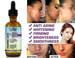 100% HYALURONIC ACID Face SERUM Moisturising Hydrating Aging Wrinkles 50ML - Picture 1 of 1