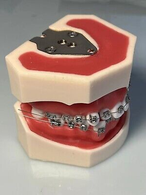 Dental Typodont Orthodontics Model Wax Teeth Training Apply To Head Model • 76.80£