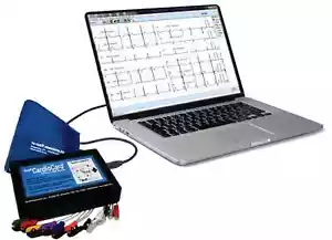 Nasiff CardioVitals ECG System - Computer Based - 12 Lead - Auto Diagnostic - Picture 1 of 8