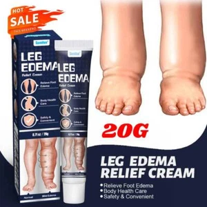 Leg Edema Relief Cream Effective Foot Swelling Reduction Natural Ingredi ents - Picture 1 of 9