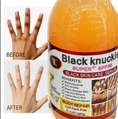 Dark Knuckle Super Serum Skin Dark Spots Lightening Serum, 125ml [USA Stock 🇺🇸 - Image 1 of 4