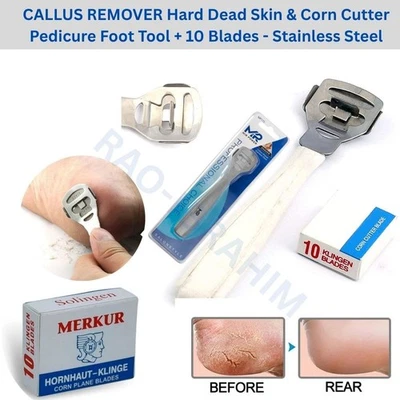 MASTERPLAST Hühneraugen Hornhautentferner Werkzeug Pediküre Fuß Füße Ferse trocken hart abgestorbene Haut Rasierer Feile