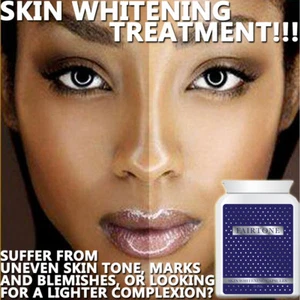 FAIRTONE WHITENING PILLS TABLETS STRONG WHITENER SKIN LIGHTER ALL SAFE NATURAL