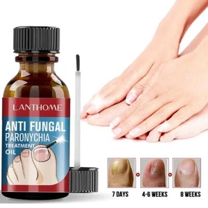 2025 Beste deutsche Zehennagelplus NailProp Anti Paronychia Oil Relief . - Picture 1 of 12