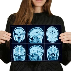 A4 - Brain CT Scans Hospital Doctor Surgeon Poster 29.7X21cm280gsm #44434 - Picture 1 of 4