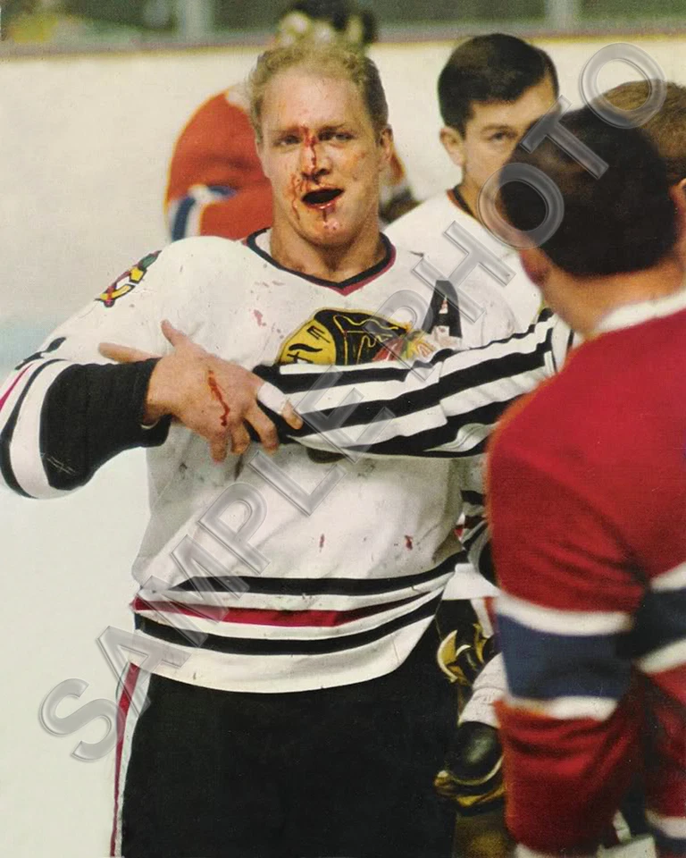 FOTO 11x14 BOBBY HULL NARIZ SANGRE CHICAGO BLACKHAWKS HOCKEY HOF THE GOLDEN JET Foto 1 de 1
