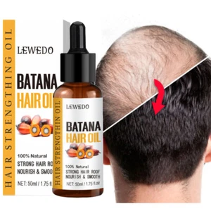50ml Batana Oil Serum For Hair Growth Healthier Thicker Fuller Anti Hair Loss - Picture 1 of 16