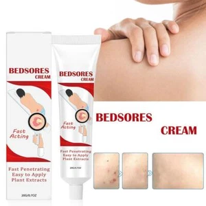 Bed Sore Cream Bedsore Ointment Bed Sores Treatment Fast Wound Healing Gel,20g - Picture 1 of 13