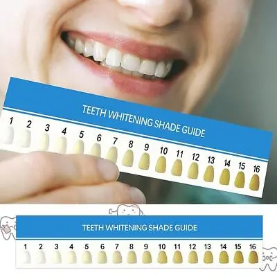 16Color Teeth Whitening Chart Cards Complete Guide For Brighter Smile • 3.01£