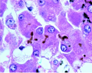 Erythrosine B (For microscopy), CAS: 16423-68-0, 5g to 100g, +85.0% dye content - Picture 1 of 3