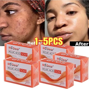 1-5PCS Kojic Acid Soap Dark Spot Whitening Turmeric Skin Bleaching Lightening - Picture 1 of 31
