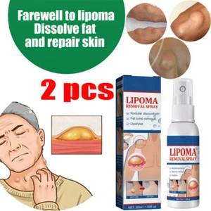 2X Lipomheilung Reduction Spray, Instant LumpFree Lipoma Removal Spray USA Hot - Picture 1 of 15