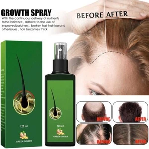30ml/120ml Neo Lozione Capelli Radice Capelli Barba BASETTE 10 Erbe LUNGHE O2L1 - Foto 1 di 17