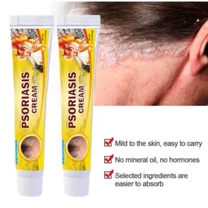 Psoriasis Cream For Bacteriostasis Dermatitis Eczema Body Psoriasis Skin Care - Imagen 1 de 8