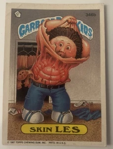 1987 TOPPS GARBAGE PAIL KIDS SKIN LES #346B - 9° SERIE - Foto 1 di 2