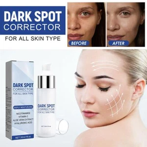 Dark Spot Remover for Face and Body, Dark Spot Corrector Serum - Bild 1 von 16
