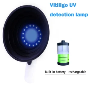 Skin Analyzer with Woods Lamp for Skin Vitiligo Detector Analysis Machine Led Re - Picture 1 of 14