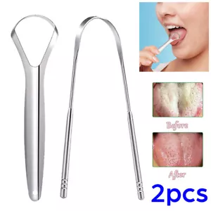 2 raschietto detergente per lingua in acciaio inox igiene dentale bocca orale - Foto 1 di 12