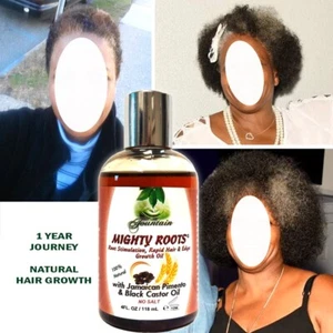 Fountain Receding Hair Growth Oil with Jamaican Pimento and Black Castor Oil - Picture 1 of 7