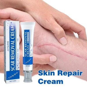 Recovery Scar Cream,acne Scars, Surgical Scars, Stretch Marks, C-section Scars - Picture 1 of 14