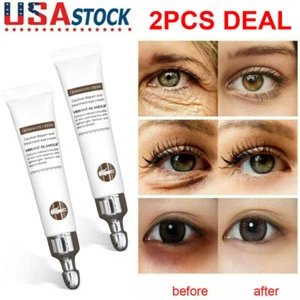 2Pcs Magic Eye Cream-28 seconds to remove eye bags / dark circles / eye wrinkles - Picture 1 of 17