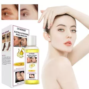 118ml Strong Yellow Peeling Oil Exfoliating Solution Body Dark For Face V3H0 - Picture 1 of 12