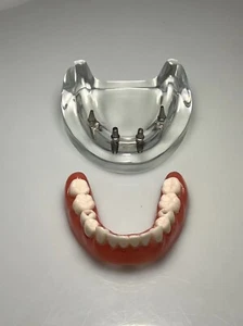 Dental Implant restoration model 4 nails denture demonstration model - Picture 1 of 10