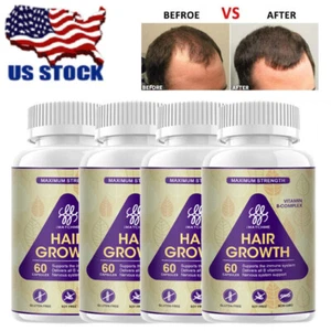1-4PCS DHT BLOCKER HERBAL HAIR FAST GROWTH PILLS PREVENT ANTI LOSS STIMULATE - Picture 1 of 15