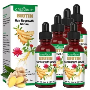 5 PACK Ginger Oil for Hair GrowthHair Growth SerumBiotin Hair Growth OilHair ... - Picture 1 of 6