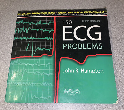 150 ECG Problems By John R. Hampton