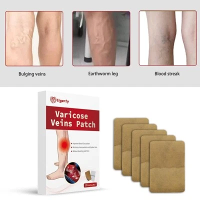 🦵10 Piezas Parche Venas Varicosas Alivio Herbal Invisible para Arañas Venas Pierna Pesada Foto 1 de 4