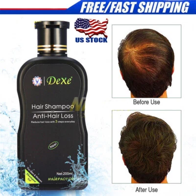 200ml Dexe Hair Shampoo Anti hair Loss Chinese Natural Herbal Hair Growth Unisex - Image 1 of 4