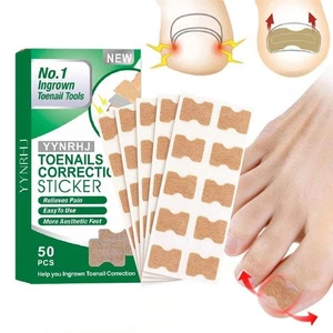 50pcs Glue Free Toenail Toe Ingrown Nail Correction Patch Sticker Professional - Bild 1 von 11