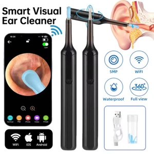 Ear Wax Removal Pick Led Light Wireless Ear Camera Otoscope Visual Kit Smart - Picture 1 of 17