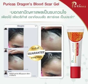 Puricas Natural Dragon's Blood Scar Gel Surgery Treat Keloid Acne Red Scars 20 g - Picture 1 of 12