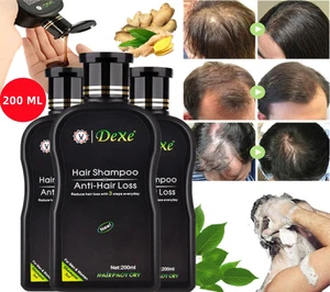 Miglior Shampoo Anti Diradamento Perdita Capelli Più Veloce Ricrescita Shampoo Biologico Uomo Donna - Foto 1 di 14