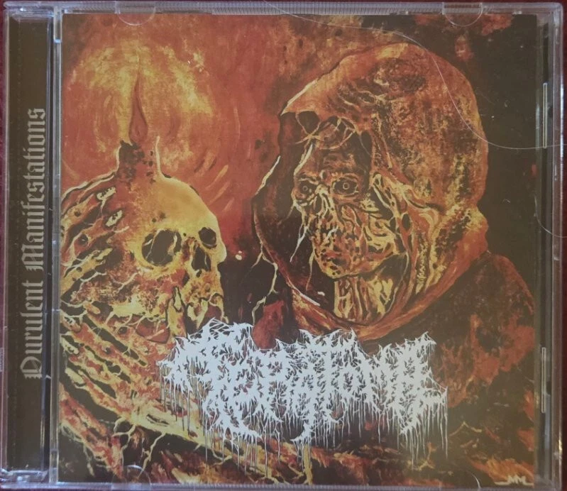 Teratoma - Purulent Manifestations(CD/2022)PUTRED ABERRATIO DRIPPING DECAY ABSU - Image 1 of 1