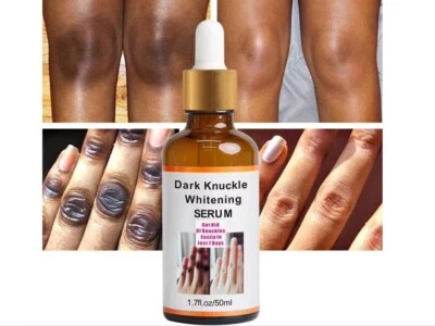 Strong Whitening Dark Skin Knuckles Feets Knees Elbows Armpit inner Thigh Serum - Image 1 of 4