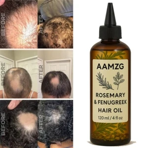 Extra Strength Rosemary + Fenugreek Herbal Hair Growth Oil | Infused With Castor - Picture 1 of 6