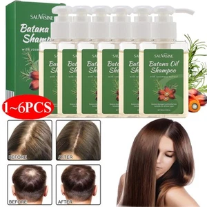 Champú Aceite Batana, Romero y Batana Crecimiento Natural del Cabello para Adelgazar el Cabello... - Imagen 1 de 31