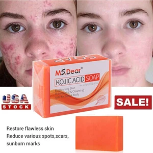 Kojic Acid Soap Dark Spot Whitening Body Soap Skin Bleaching Lightening 100g - Picture 1 of 17