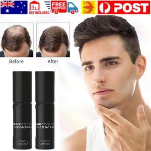 Hair Concealer Cream Sweat-Proof Scalp Coverage for Bald Spots & Thinning Hair - Picture 1 of 15