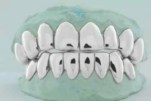 925 Solid Sterling Silver PERM,PERMANENT Cut Custom Fit Grill Grillz - Picture 1 of 5
