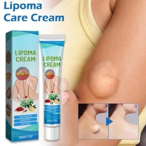 20g Lipoma Soothing Cream Instant Ointment RelievingDiscomfort Fat Agglomerat - Picture 1 of 13