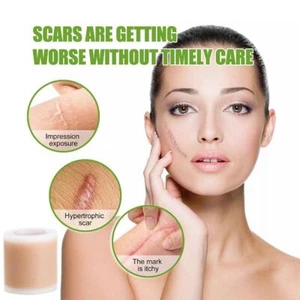 Scar Silicone Sheet Gel Patch Removal Skin Treatment Repair Wound Burn-New - Bild 1 von 15